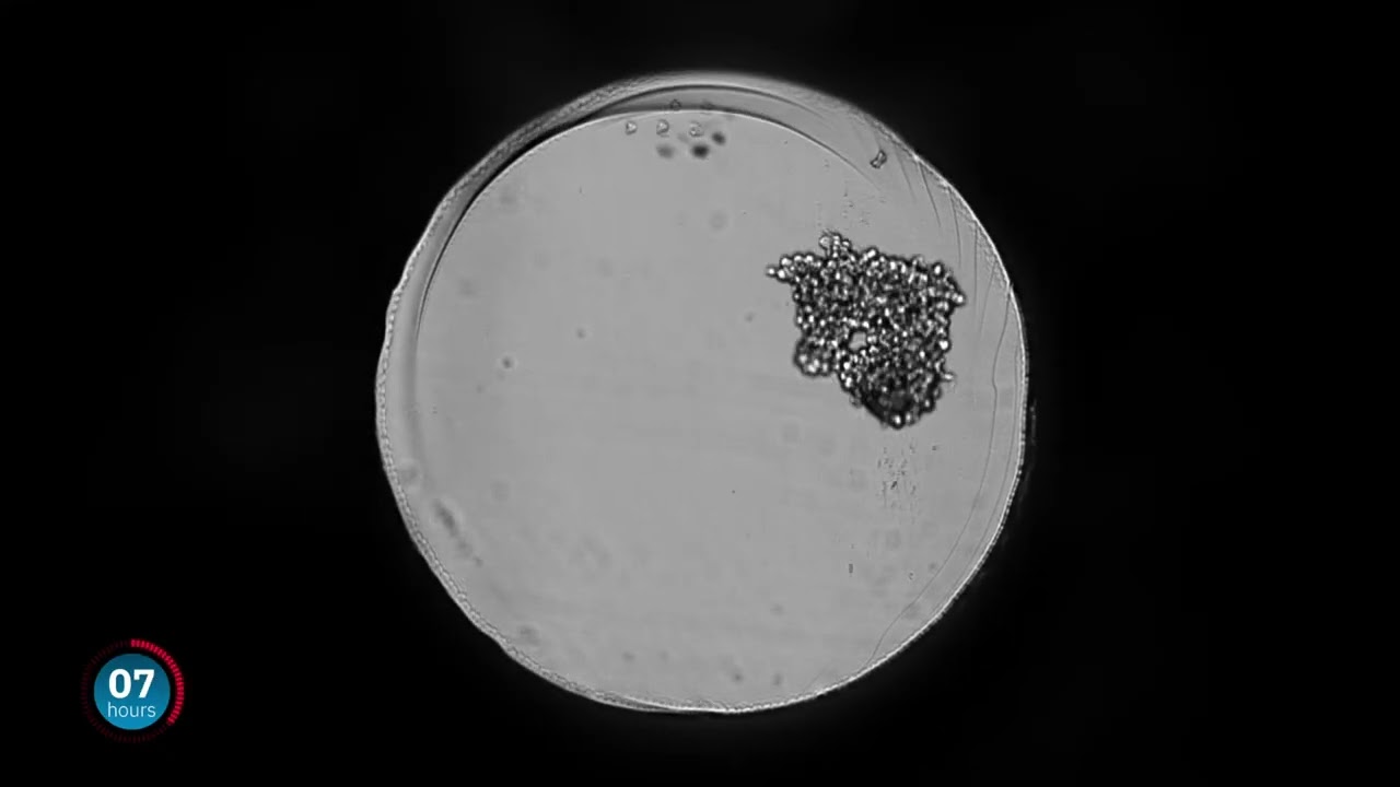 Tracking and imaging organoid activity straight from the incubator with the CytoSMART Omni