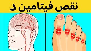 5 علامات نقص فيتامين د و كيف تقوم بتعويضه