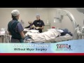 Mild Procedure at Southeastern Spine Instutitute