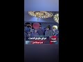 نجاح طبي جديد ... عملية دقيقة لاستئصال كيس مائي من القلب النابض