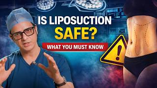 Liposuction: Is It Safe? Complete Awareness Guide