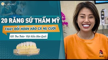 RĂNG SỨ THẨM MỸ - CHIA SẺ CỦA KHÁCH HÀNG VIỆT KIỀU HÀN QUỐC LÀM 20 RĂNG SỨ