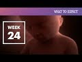 24 Weeks Pregnant - What to Expect Your 24th Week of Pregnancy