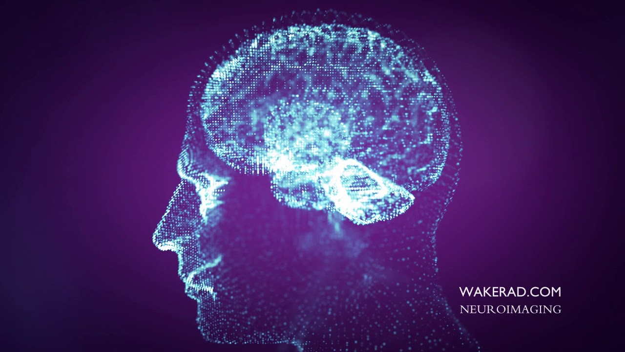 Wake Radiology UNC REX Healthcare 2019 Neuroradiology Commercial - 15 sec