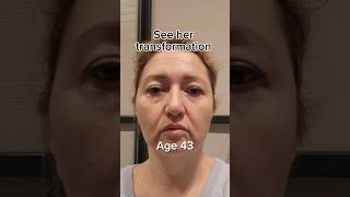 See her transformation | Face Fitness | Face Yoga | Facial Massage