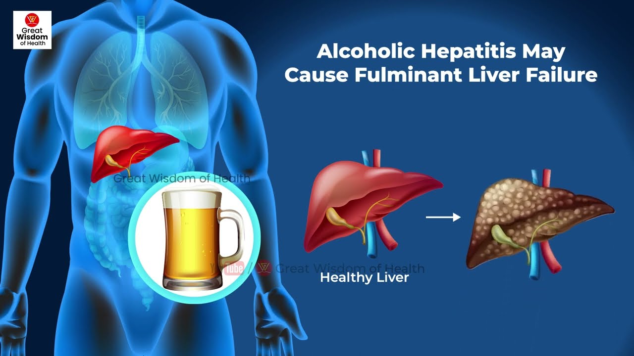 What is Fulminant Hepatitis |  Fulminant Hepatic Failure | Hepatitis