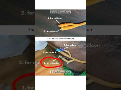 Wideo: 3 sposoby użycia cewnika