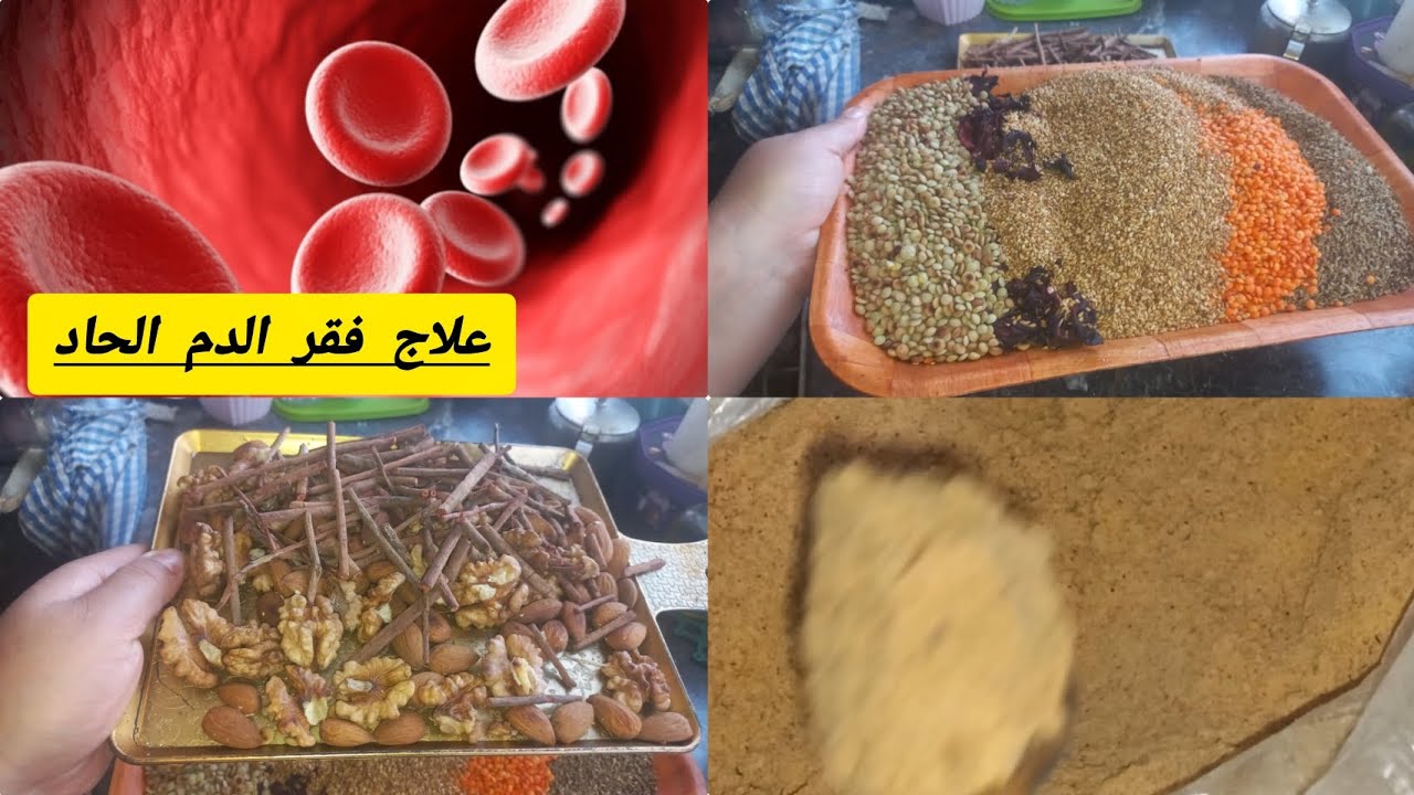 الوصفة مجربة لفقر الدم الأنيميا لوكان نقص الحاد وشحوب البشرة👍👌