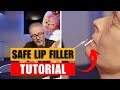 How to create safe lip results using the 4mm needle technique