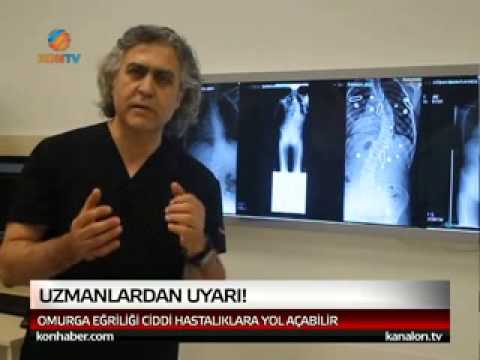 OMURGA EĞRİLİĞİ CİDDİ HASTALIKLARA YOL AÇMAKTADIR