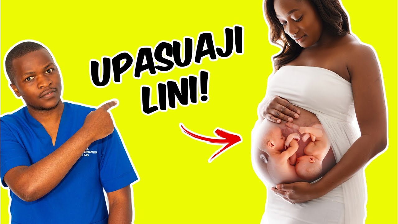 Lini Upasuaji Wa Mimba Ya Mapacha Hufanyika? | 👶👶 Mapacha Wako Wako Tayari?