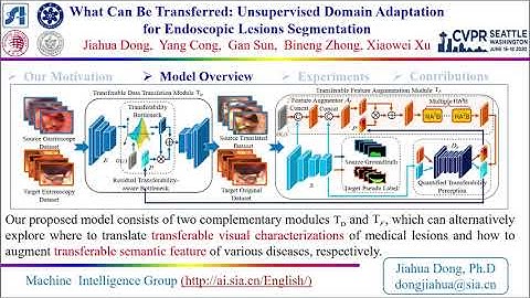 What Can Be Transferred: Unsupervised Domain Adaptation for Endoscopic Lesions Segmentation