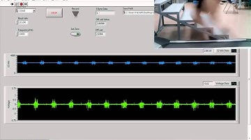 Wireless sEMG using Xbee Module_Vastus Medialis