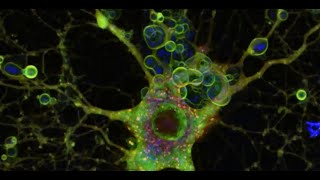 Glial cells and neurological disease research