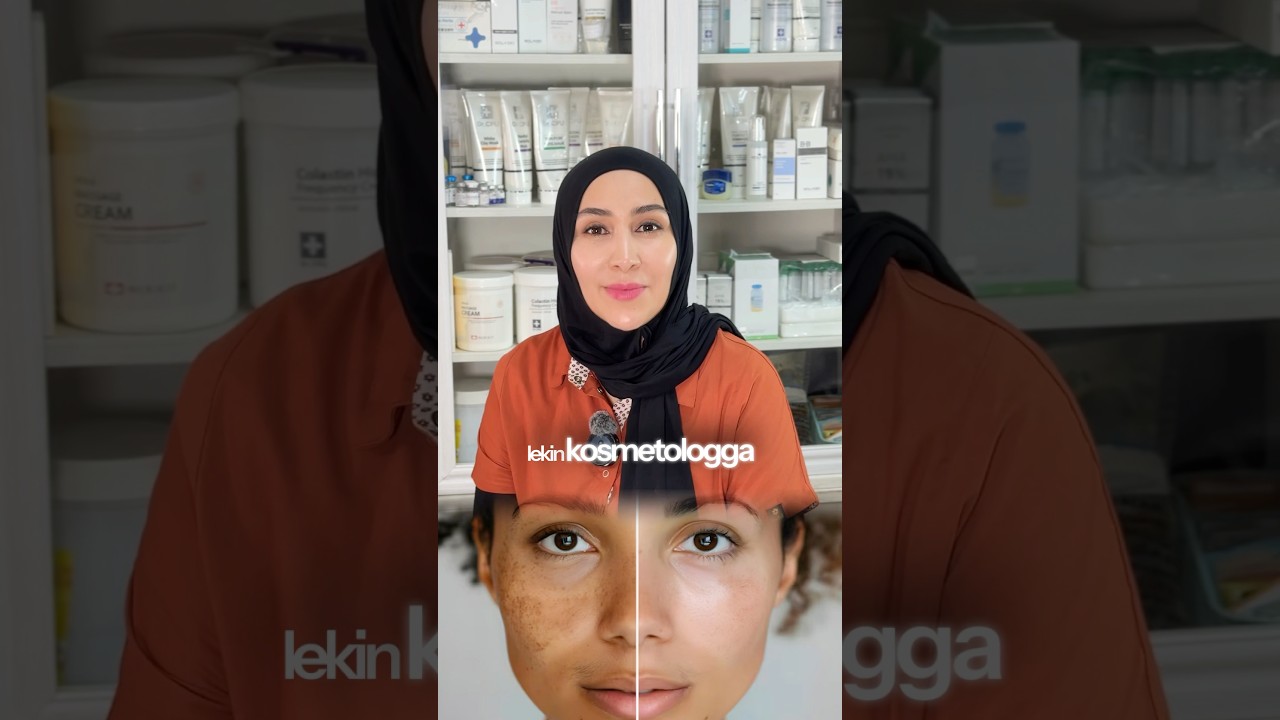 Yuzdagi dog‘larni qanday ketkazish mumkin 