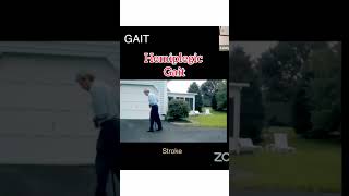 Hemiplegic Gait #shorts #orthopaedicprinciples