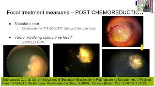 AIOC2026   GP50 When and how of the focal treatment measures and targeted treatments for IORB  Dr Ra