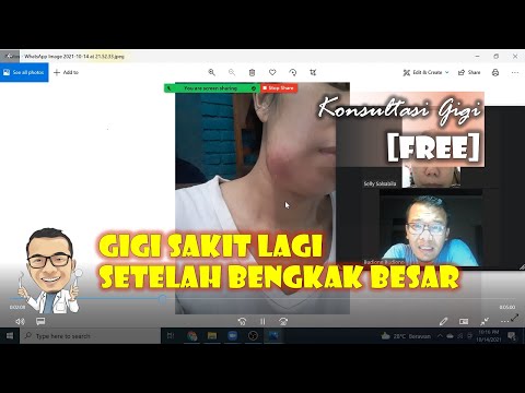 Pipi sampai bengkak karena sakit gigi [konsultasi online]