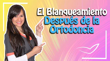 ¿Cuánto tiempo debo esperar para blanquear mis dientes después de la ortodoncia?