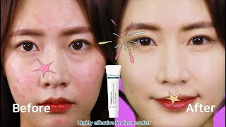 Best Seller Moisturiser for Sensitive & Dry Skin- Cellapy A.Repair Cream