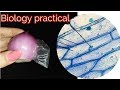 Biology practical| 9th biology practical | prepare slide of onion epidermis