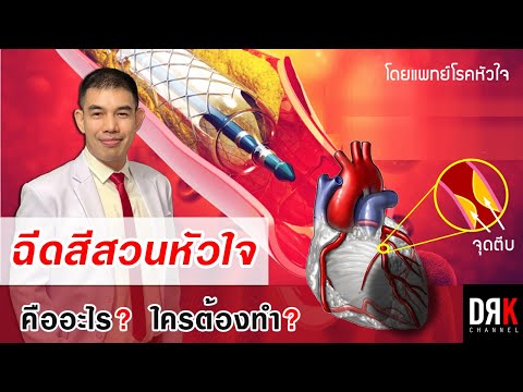 ฉีดสีสวนหัวใจ ❤️ คืออะไร ใครต้องทำ ? | นายแพทย์ กิจจา จำปาศรี