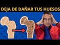 5 "ASESINOS SILENCIOSOS" que DESTRUYEN los HUESOS y ARTICULACIONES