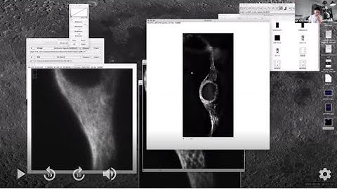 Deconvolution deconvolved