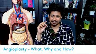 Angioplasty surgery procedure in Hindi | angioplasty me kya hota hai?