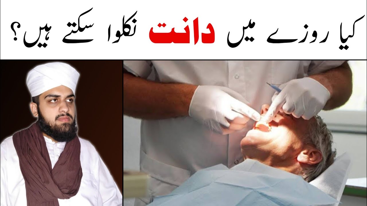 Rozay Main Teeth Nikalwana Kaisa? | Muhammad Hassan Rasool - YouTube