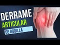 DERRAME ARTICULAR #derramearticular #artrosisderodilla #juancalbornoz