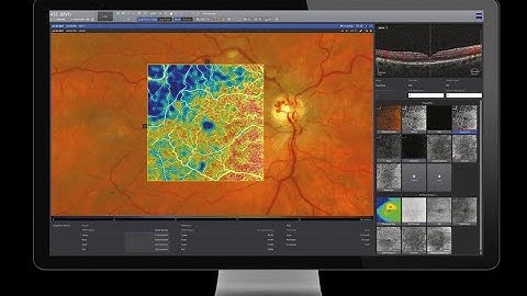 Video Tutorial Forum Retina Workplace