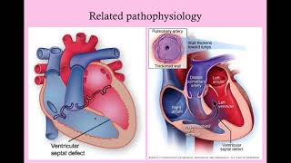 Cardiac Disease in Pregnancy - CRASH! Medical Review Series