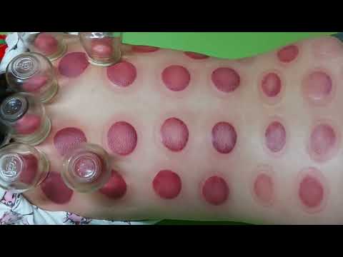 Video HÔM NAY VÔ MÁNH TÓM ĐƯỢC EM ĐAU VAI GẤY, GIÁC HƠI ĐEN... - youtube