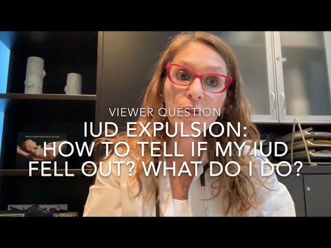 24) IUD Expulsion: How Can I Tell if My IUD Fell Out? What Do I Do?