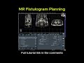 MR Fistulogram Slice Planning #mri #medicalimaging #radiology #radiographer #radtech #ctscan #xray