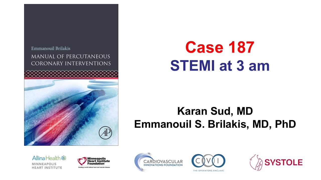 Case 187: Manual of PCI - STEMI at 3 am