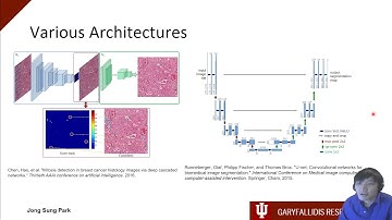 Brain Extraction using V-Net and CRF layers