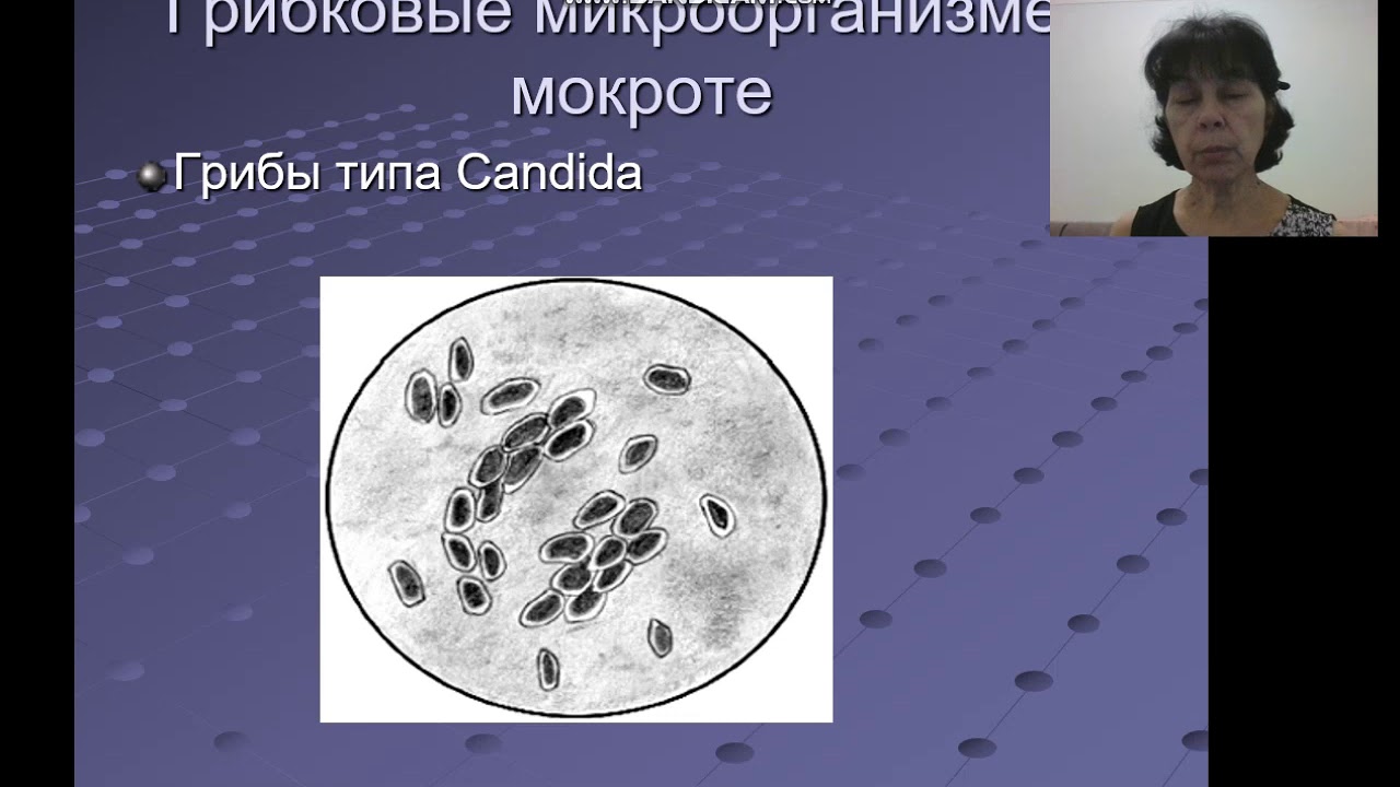 Исследование мокроты. Микроскопическое исследование мокроты альвеолярные макрофаги. Макрофаги в мокроте фото. Альвеолярные макрофаги в мокроте.