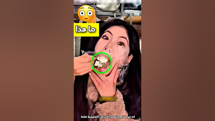 تريد تأكل الكعكة الرائعة بطريقة مميزة وبعدها هذا اللي صار 😳 #shorts #shortvideo #shortsviral