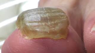 ドイツ式フットケア【相模原、町田、厚木】