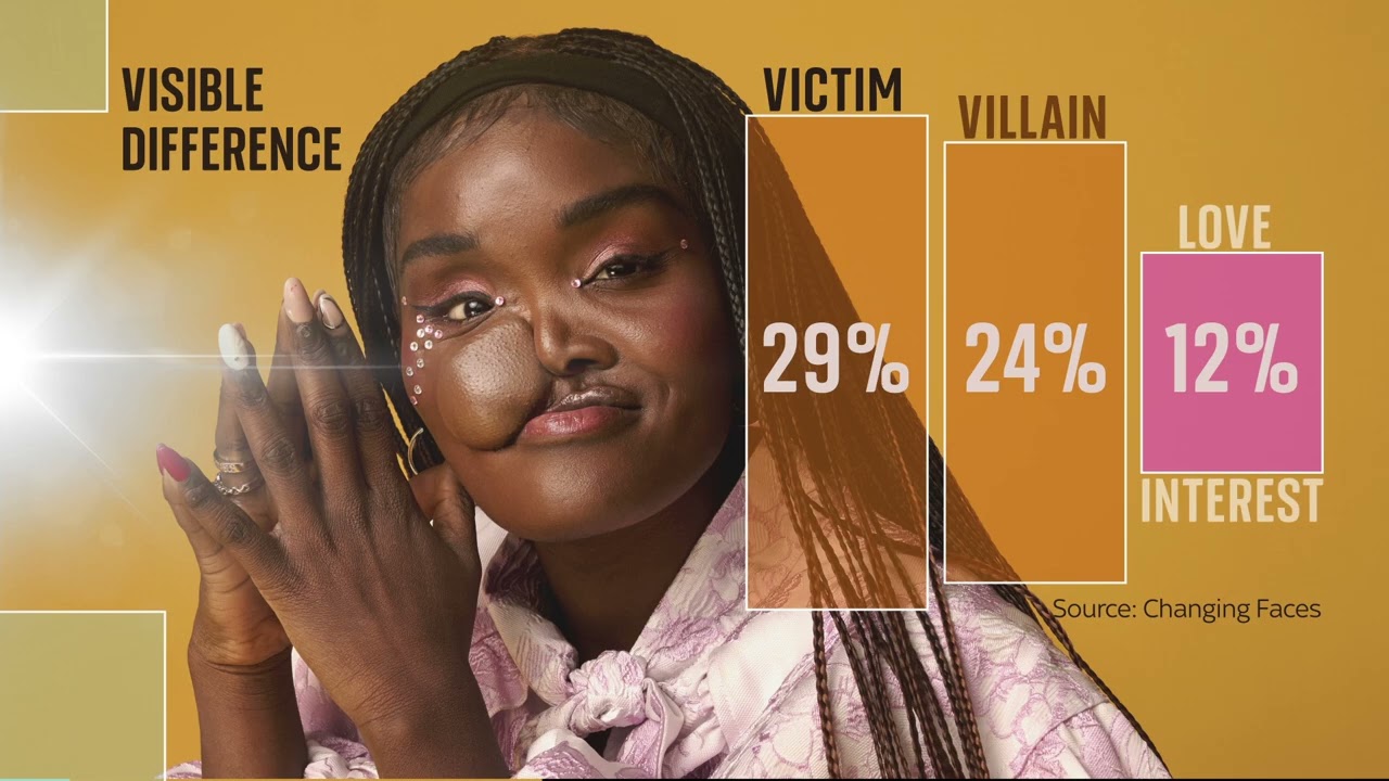 What if Romeo had a scar? Or Juliet a facial difference? The actors challenging screen conventions