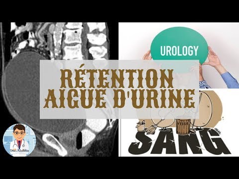 RÉTENTION AIGUE D&rsquo;URINE ( DÉFINITION , PHYSIOPATH , CAUSE , TRAITEMENT ) - DOCTOR ALADDIN -