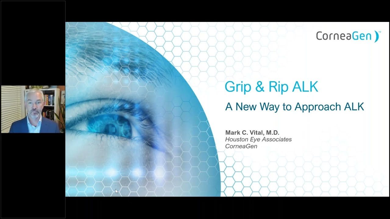 “Grip and Rip” ALK – A New Way to Approach ALK