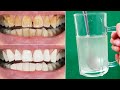 In two minutes, the white teeth whitening and globe such as pearls, this recipe / treatment at home