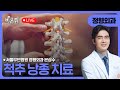 척추낭종 치료 / 서울부민병원 정형외과 은상수
