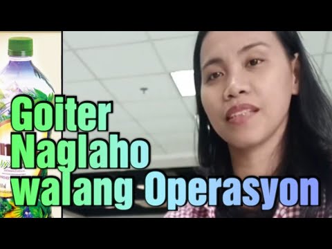 Intra Goiter Testimonials - cured witthout operation