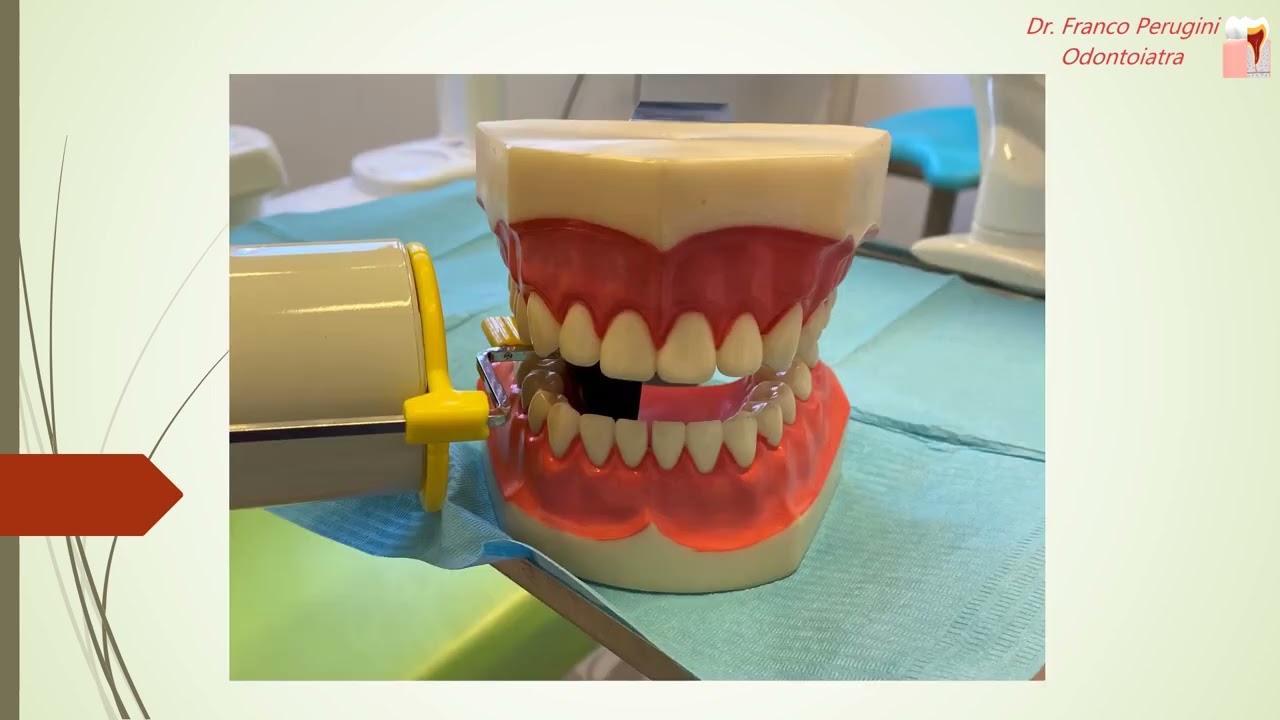 L'uso del centratore di Rinn