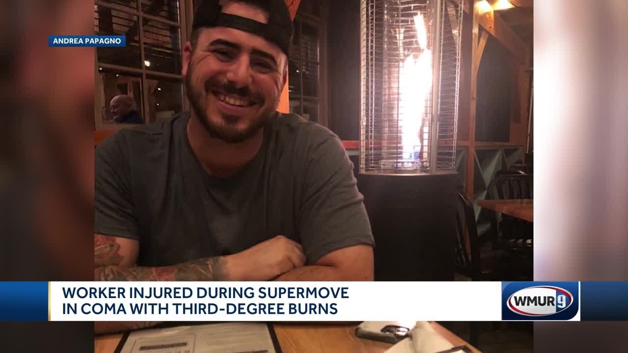 Worker injured during 'supermove' in medically-induced coma with third-degree burns