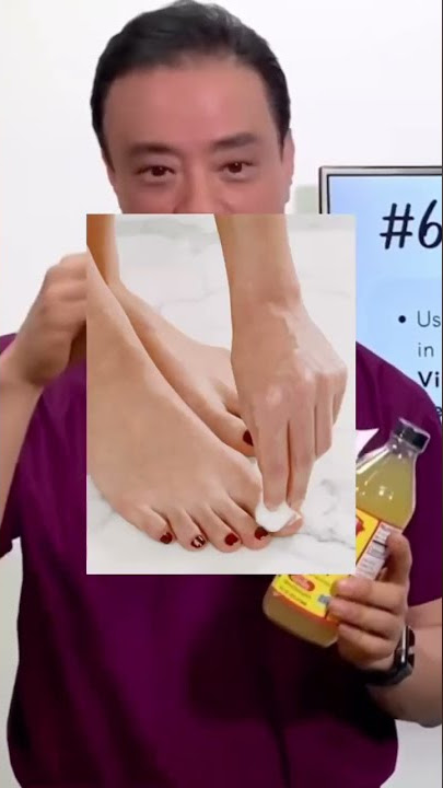 Lega Dalam 5 Menit! Obat Rumahan Mudah untuk Kuku Tumbuh ke Dalam #shorts